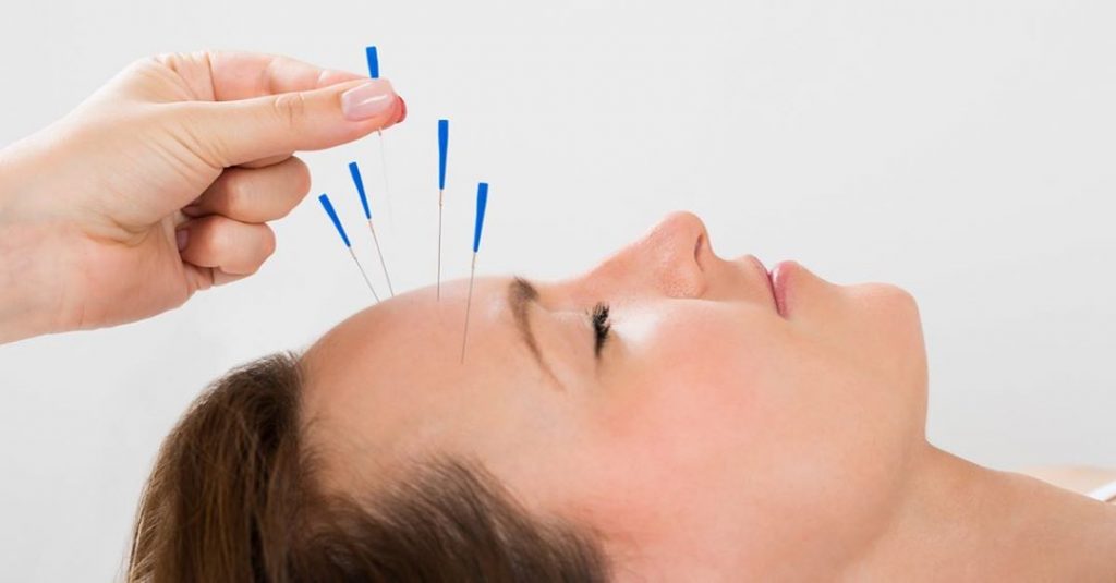 Acupuncture et système immunitaire - Dr NGUYEN à Paris