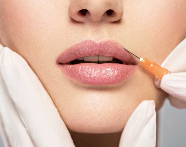 injection-acide-hyaluronique-repulper-levres-paris-14-dr-nguyen Les injections d'acide hyaluronique pour repulper les lèvres à Paris - Dr Nguyen