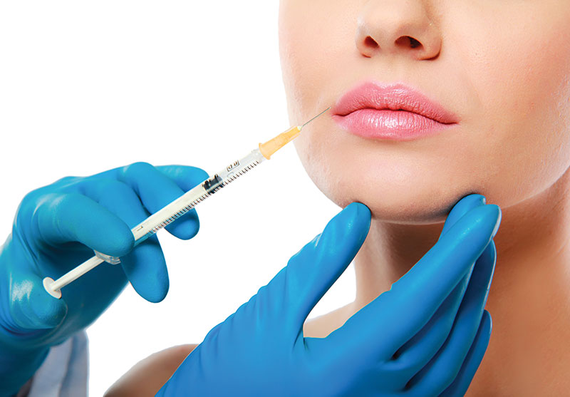 Injections d'acide hyaluronique pour combler le pli d'amertume à Paris 14 - Dr Nguyen