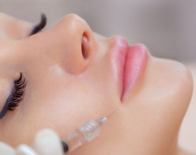 injection-acide-hyaluronique-combler-pli-amertume-paris-dr-nguyen Injections d'acide hyaluronique pour combler le pli d'amertume à Paris - Dr Nguyen