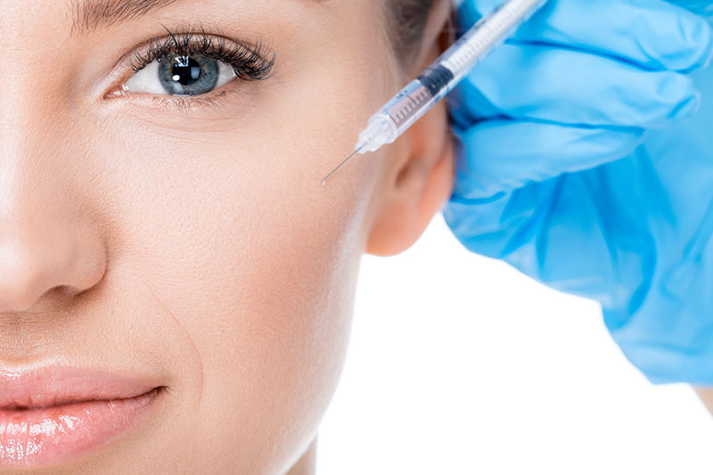 Injection d'acide hyaluronique pour les pommettes à Paris - Dr Nguyen