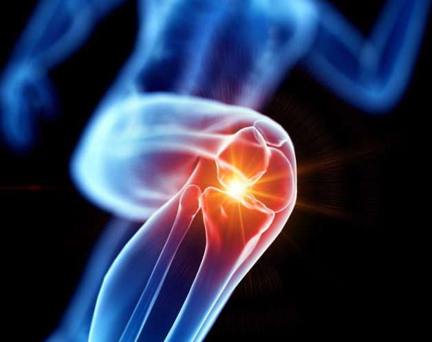 arthrite-infectieuse-mesotherapie-rhumatologie-paris-dr-nguyen La spondylarthrite ankylosante par mésothérapie à Paris - Dr Nguyen