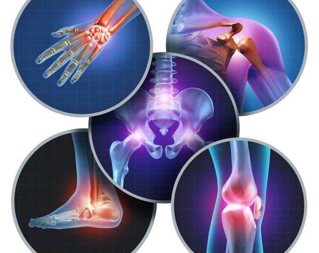 arthrose-mesotherapie-troubles-sportifs-paris-dr-nguyen Arthrose par mésothérapie à Paris - Dr Nguyen