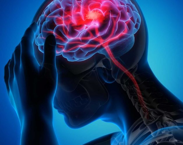 traitement-mesotherapie-nevralgie-arnaud-paris-dr-nguyen Névralgie d'Arnaud par mésothérapie à Paris - Dr Nguyen