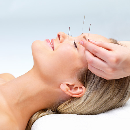 Lifting par acupuncture à Paris - Dr Nguyen