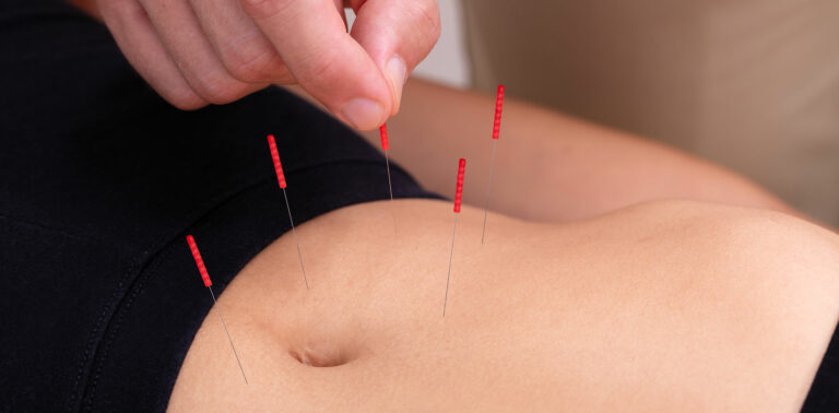 Comment l'acupuncture peut soigner le fibrome volet III - Dr Nguyen à Paris