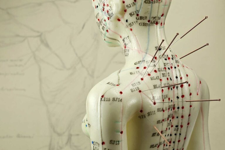 Acupuncture après AVC par le dr Nguyen à Paris