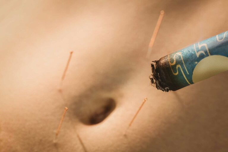 L'acupuncture dans la lutte contre la résistance à l'insuline