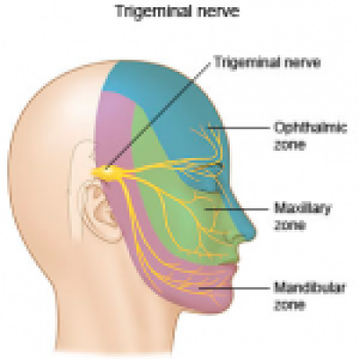 Névralgie faciale et acupuncture - Dr NGUYEN, acupuncteur à Paris