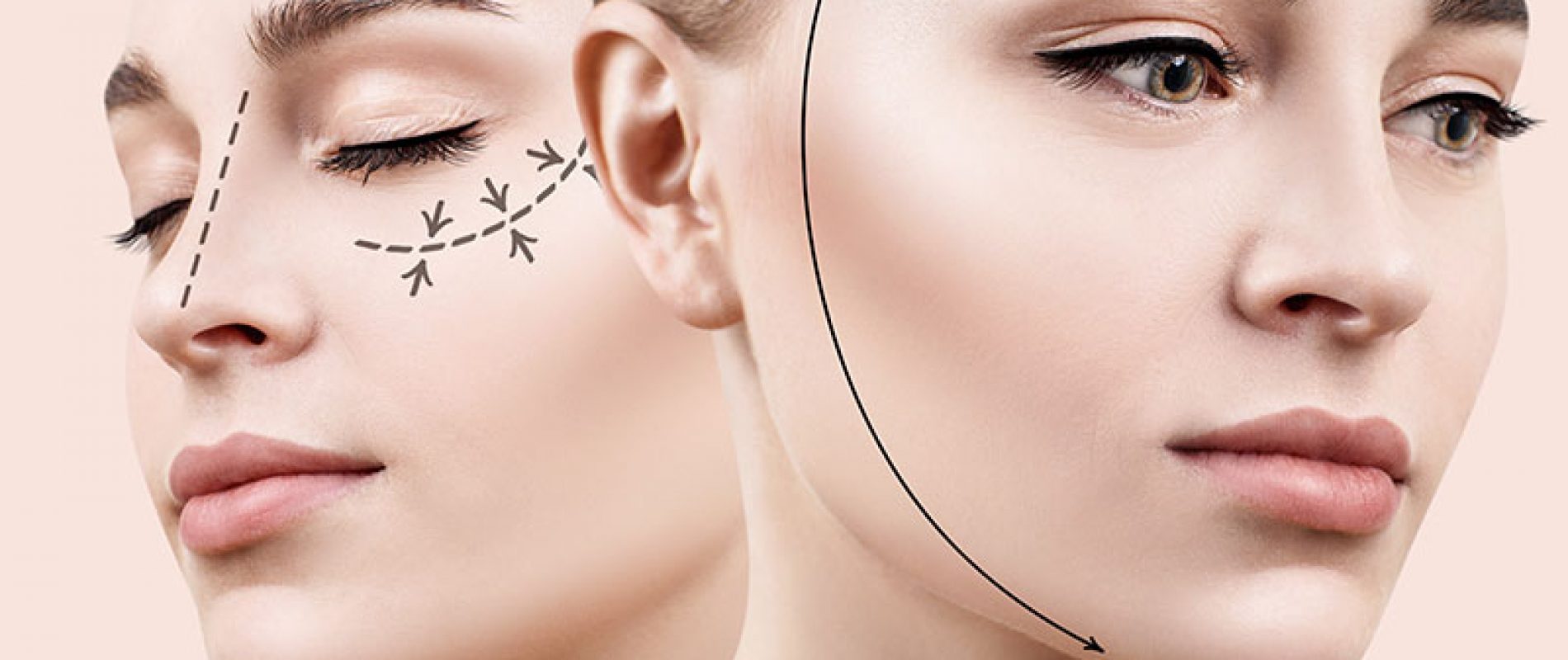 Lifting par acupuncture et ovale du visage à Paris - Dr Nguyen