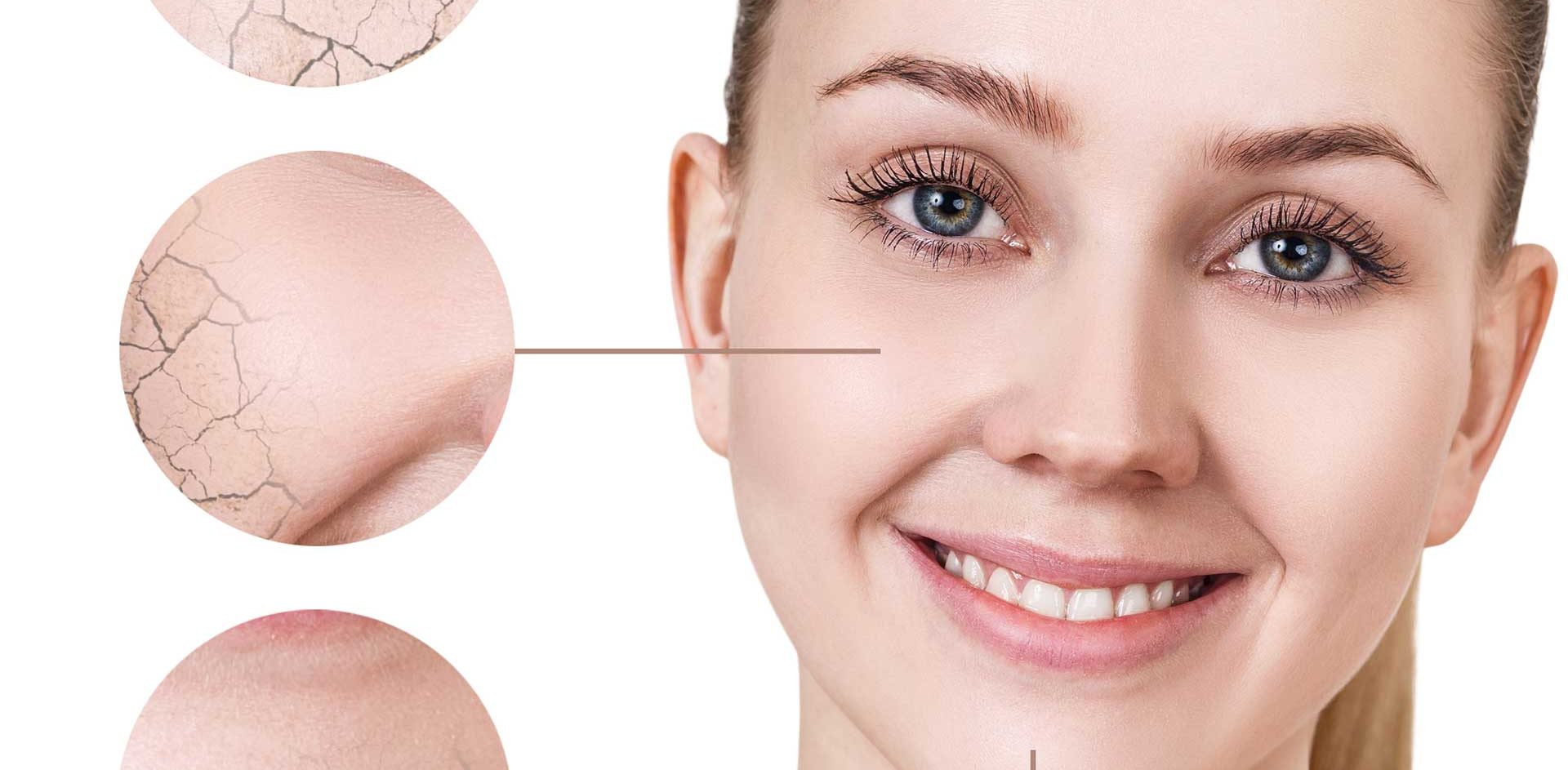 Peeling superficiel à Paris par le dr Nguyen