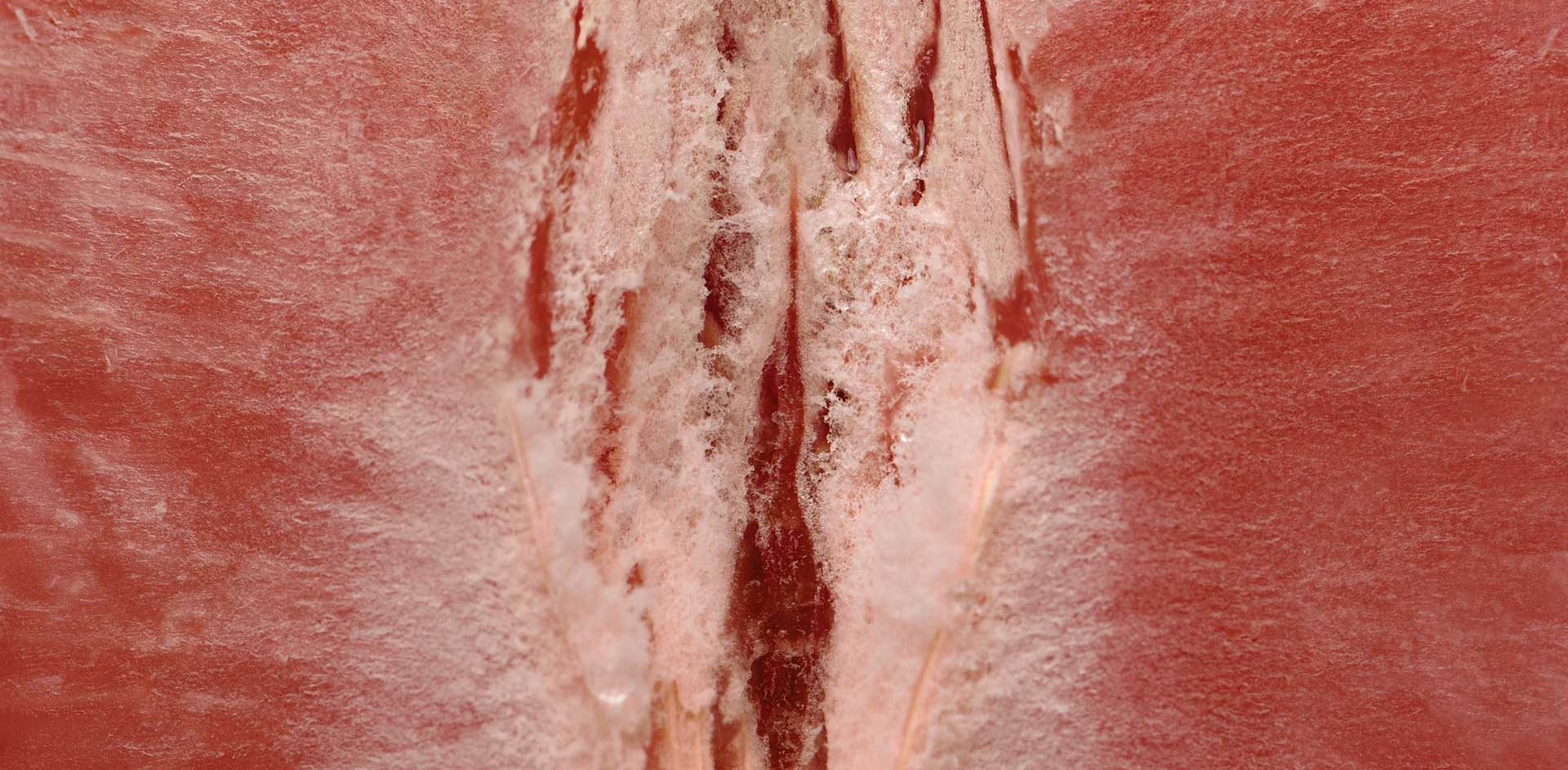 vaginisme-acupuncture-dr-nguyen-paris Vaginisme et acupuncture - Dr NGUYEN à Paris